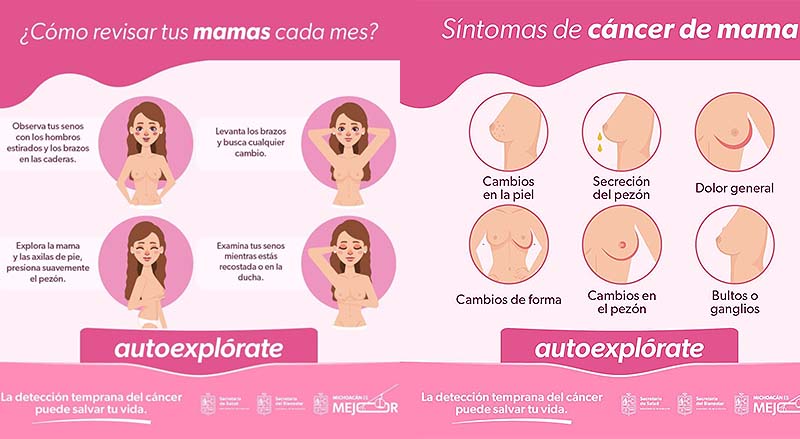 Reconoce los síntomas del cáncer de mama para actuar de inmediato